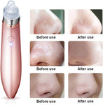Electric Facial Pore Cleaner - Saadstore