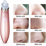 Electric Facial Pore Cleaner - Saadstore