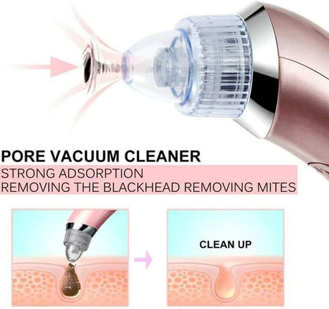 Electric Facial Pore Cleaner