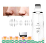 Ultrasonic Facial Cleaner