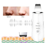 Ultrasonic Facial Cleaner - Saadstore