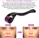 Derma Roller Micro Needling - Saadstore