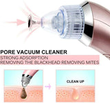 Electric Facial Pore Cleaner - Saadstore